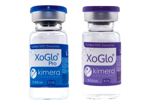 Exosomes Treatment, Xoglo Exosomes